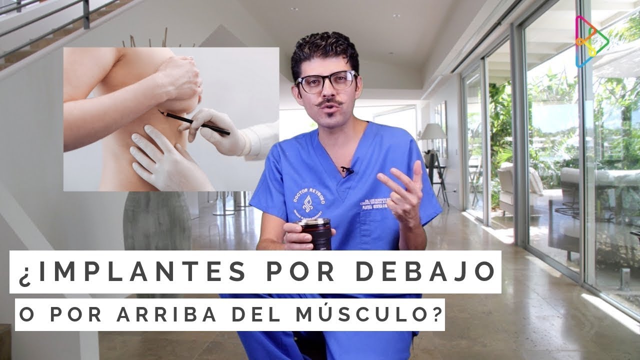 Watch ¿Implantes por debajo o por arriba del músculo Now ¿Implantes por debajo o por arriba del músculo