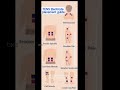 TENS Electrode Placement