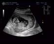 Baby S First Dvd