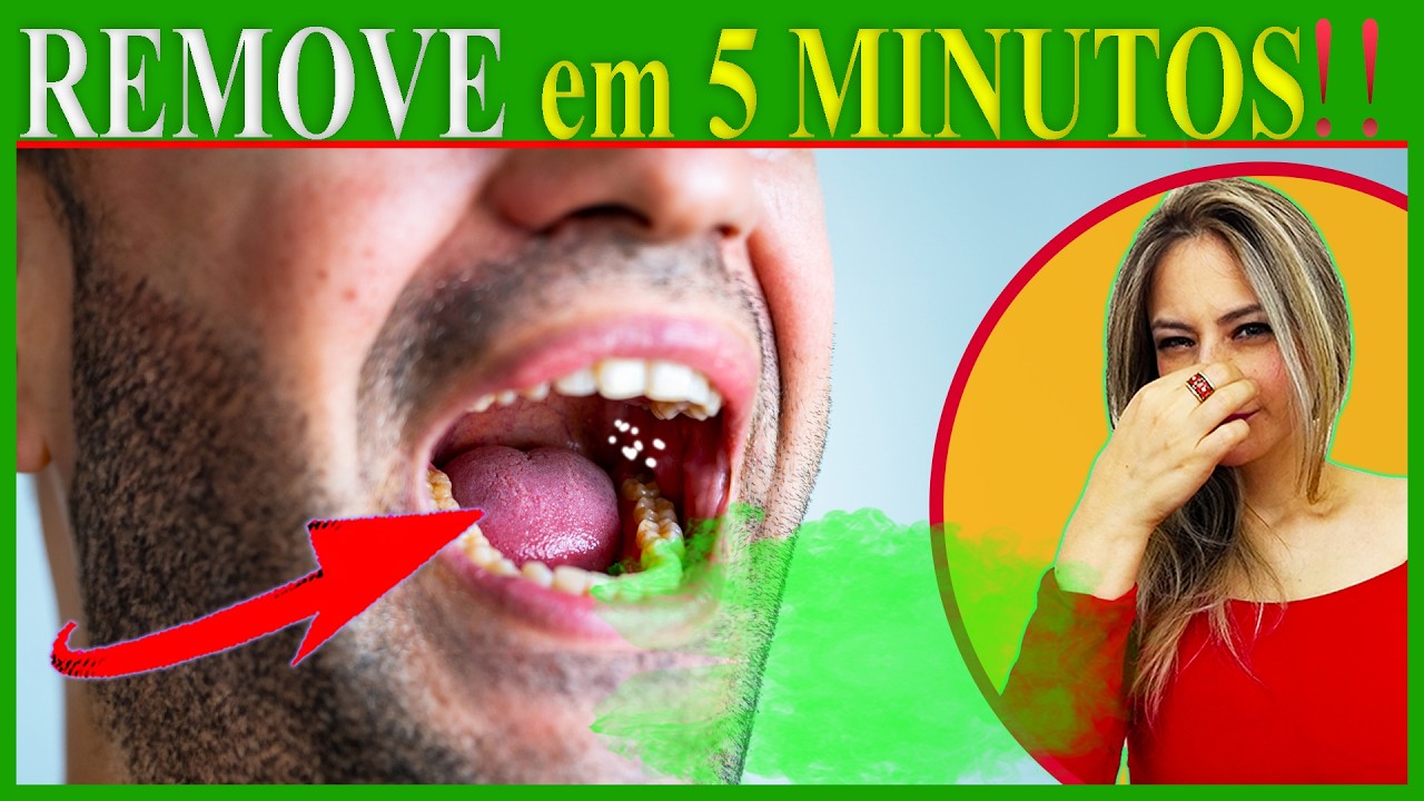 5 Ways to Remove Caseos AT HOME (INFALLIBLE) ends bad breath!!!