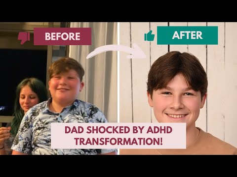 ADHD Before & After: Dad Shares Shocking Transformation of His Child!
