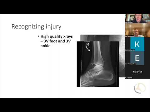Talus Fractures Introduction INDICATIONS JUNE 2023