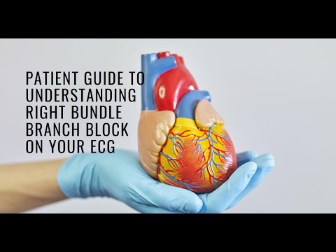 Understanding Right Bundle Branch Block (RBBB) on Your ECG: A Patient Guide.