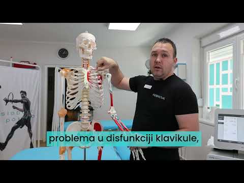 Trnjenje ruku, prstiju, cele šake - Fizionova