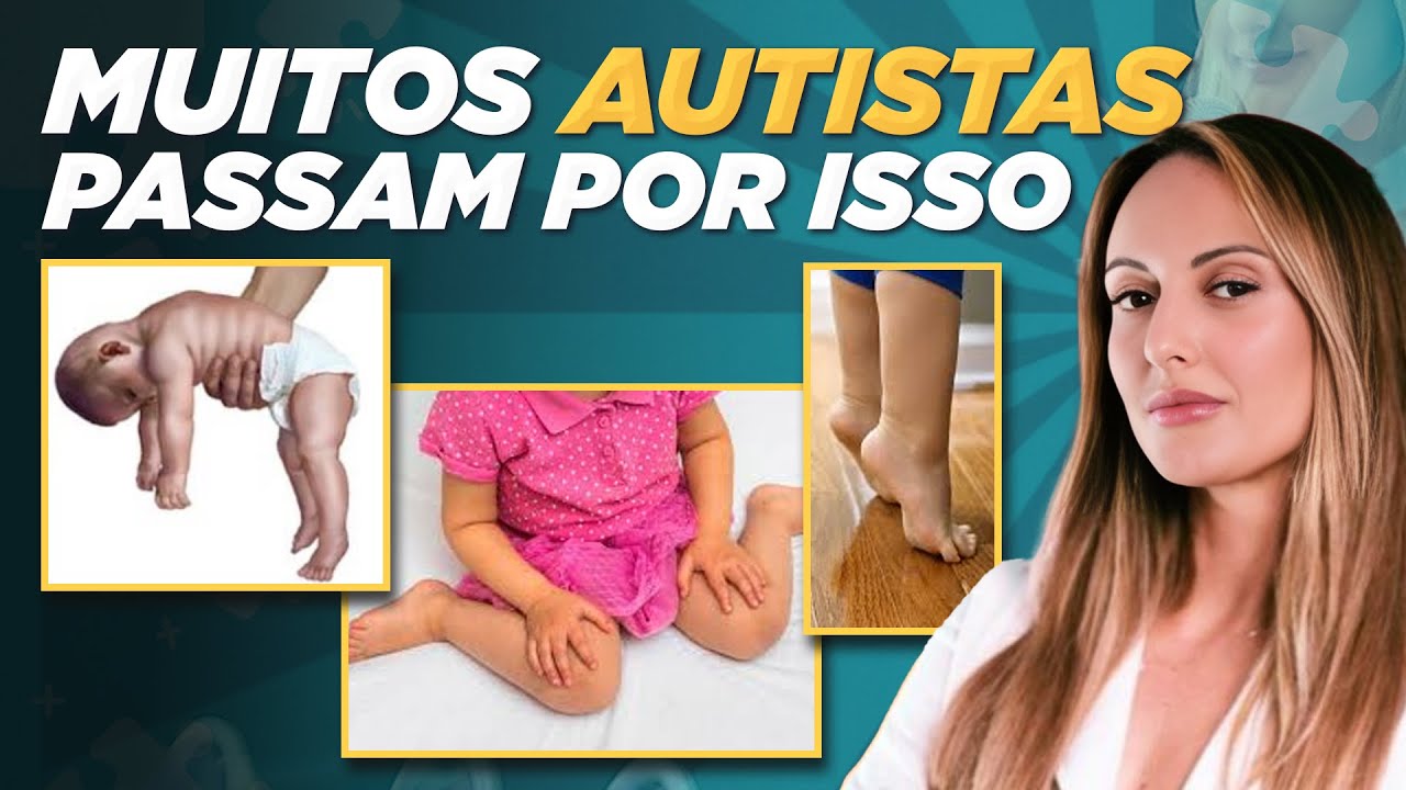 Quais são as defasagens motoras mais comuns em crianças autistas? Dra. Carolina Quedas responde