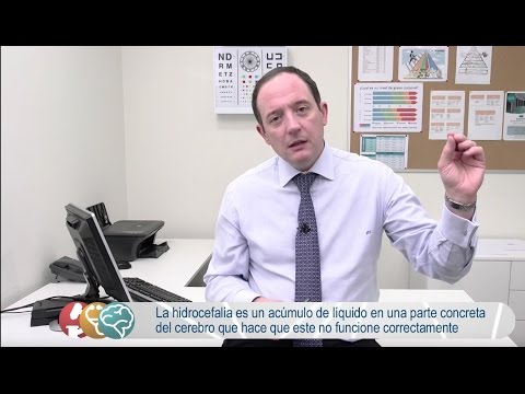Hidrocefalia: causas y tratamientos