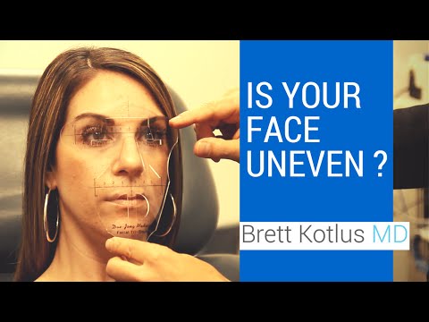 Facial symmetry and asymmetry