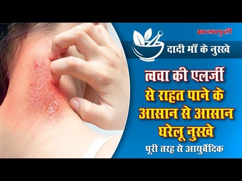Dadi Maa Ke Nuskhe, Skin Infection से छुटकारा दिलाएंगे ये घरेलू उपाय,Nuskhe