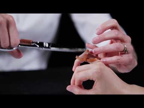 Anti swan neck orthosis (Orfit Strips) - Splinting techniques 7/10