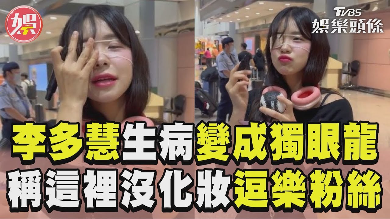 影音/李多慧眼睛生病變成獨眼龍! 笑喊「這裡沒化妝」逗樂粉絲
