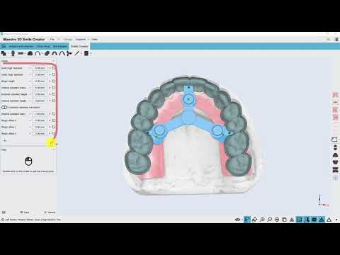 Créateur de Sourire | Mockup Numérique | Guide de Prothèse 3D