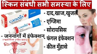 Candid Cream || दाद,खाज,खुजली व फंगल इन्फेक्शन में उपयोगी || dad Khaj khujali Ki Dava