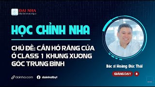 Học chỉnh nha - Cắn hở răng cửa ở Class 1 khung xương góc trung bình. #niengrang #study #hocchinhnha