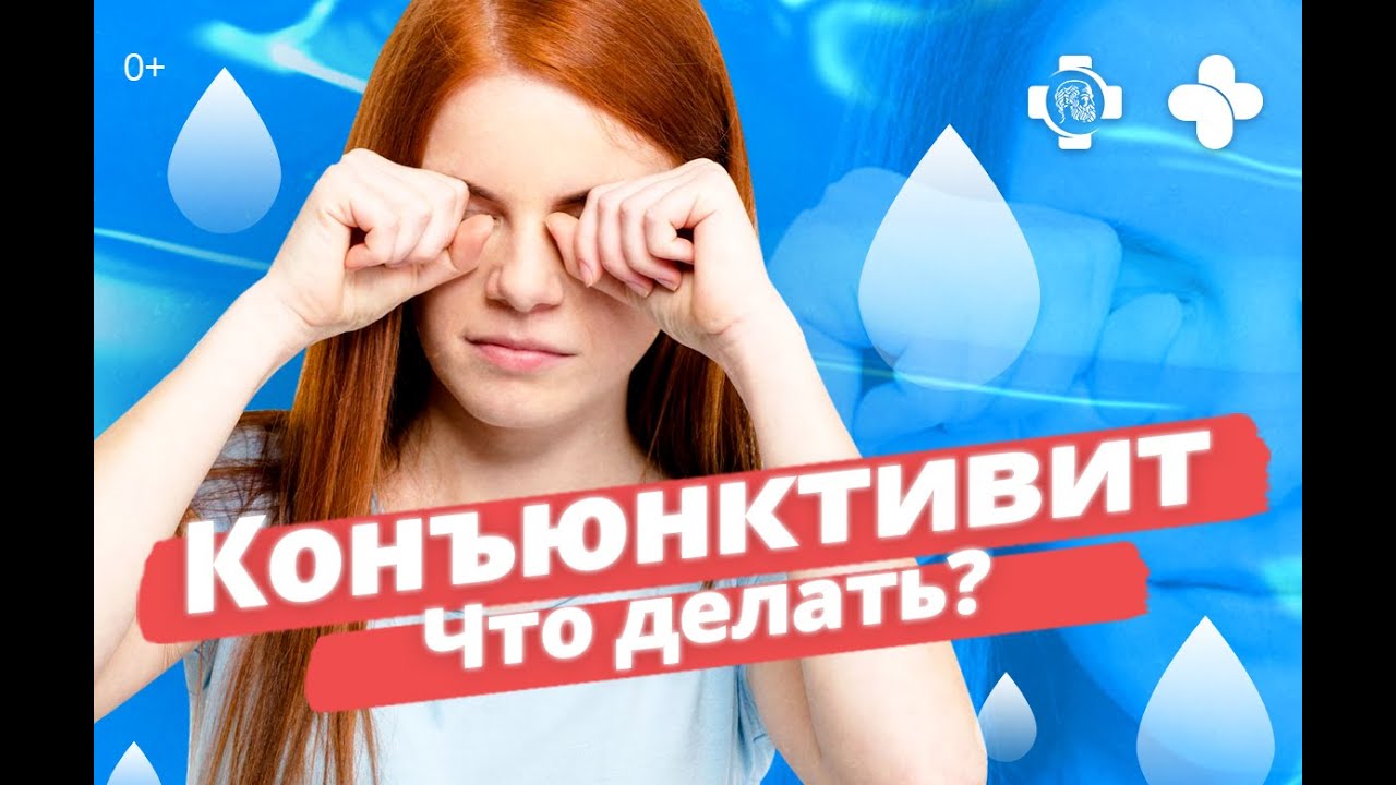 Что делать если у Вас осложненная форма аденовирусного конъюнктивит Мнение эксперта клиники YourMed