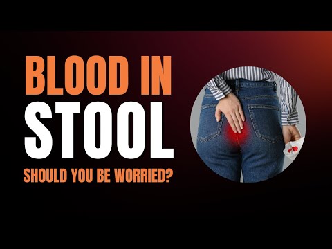 The Hidden Dangers of Blood in Stool | Discover The Top 6 Causes Of Blood In Stool