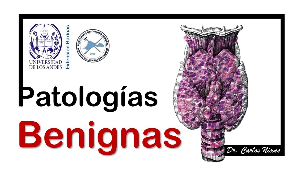 Patología Benigna de la Glándula Tiroides.