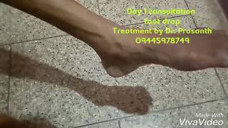 preview picture of video 'Foot drop treatment in Ayurveda'