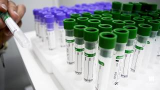 Explicación de las tapas de los tubos.