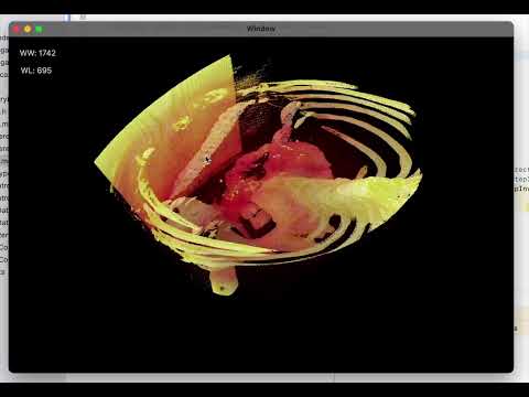 保健学科 PHORLIX 3D Viewer