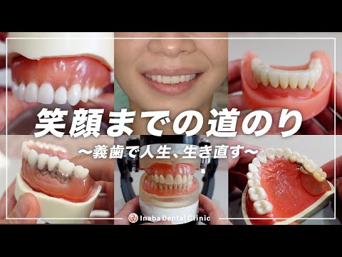 笑顔までの道のり〜義歯で人生、生き直す〜