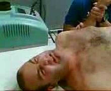 Differenze vitaprost dal forte, più Il video come fare massaggio prostatico