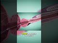 Prostate Treatment Revolutionary ITIND Procedure