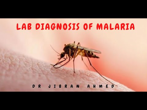 OSTEOGENIC TX II FLETCHERS 5TH E II ROBBINS 10TH E II POST GRADUATE LEARNING II DrJIBRANAHMED