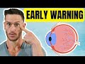 This Disease Ruins Your EYESIGHT BEFORE You have Symptoms (discover it early)