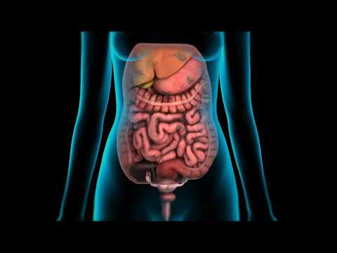 INTRAPERITONEAL HYPER THERMIC CHEMOPERFUSION OR CHEMOTHERAPY HIPEC OR IPHC