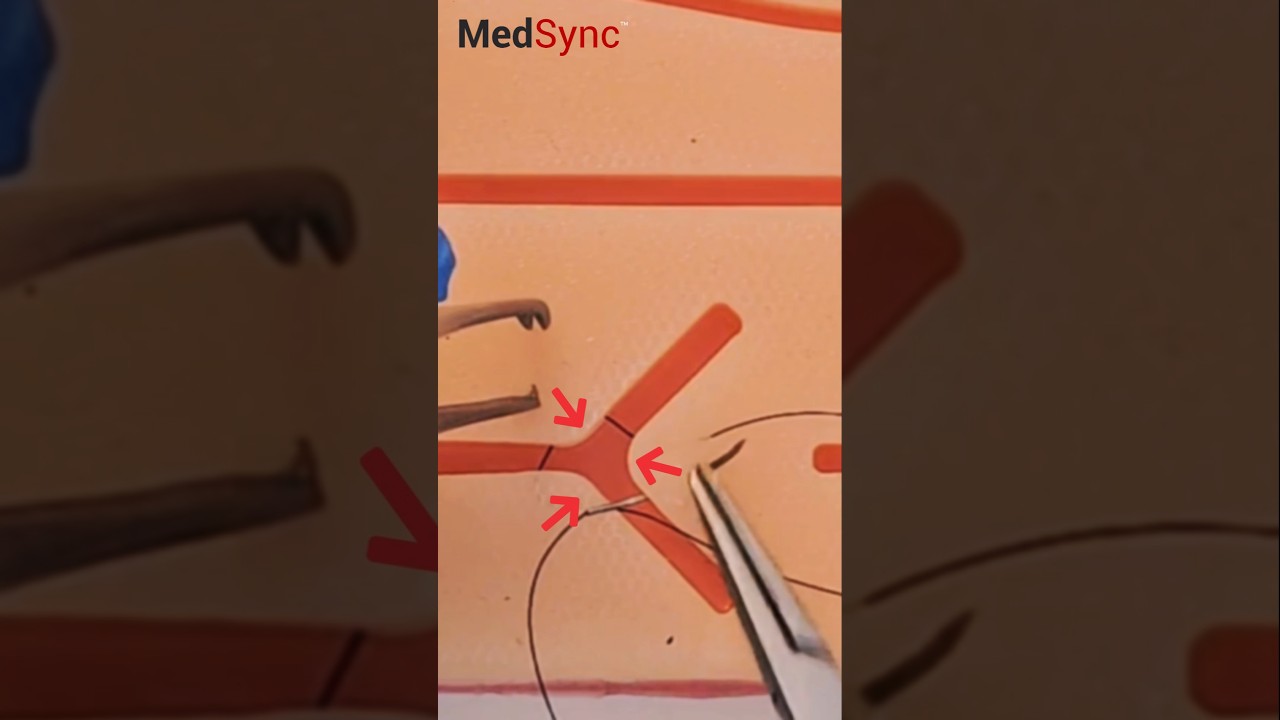 3 Pieces ONE SUTURE: Do This https://www.medsyncltd.com #meded #suture #skills #medsync #medstudent