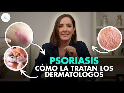 🔴 TRATAMIENTO para la PSORIASIS ¿Tiene CURA? | Te lo EXPLICO TODO @drapilarochoa - Dermatologa