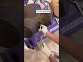 Obgyn Shows A Forceps Delivery Shorts Birth