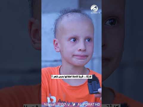 شاهد بالفيديو.. كارثة .. قرية كاملة في #كركوك بدون شعر !!