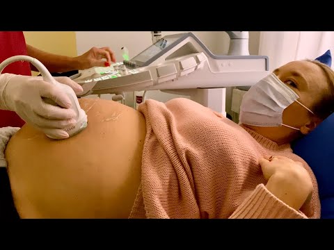 Gravid vecka 33 - Tillväxtultraljud, är bebisen för stor? VLOGG