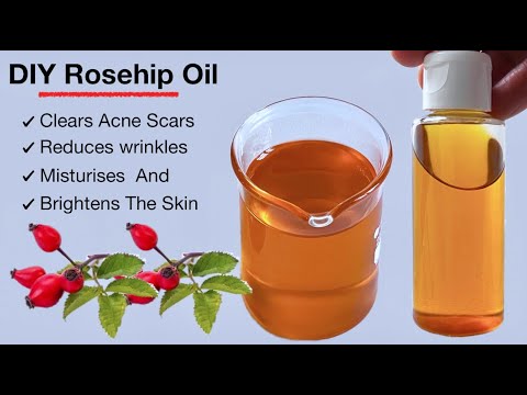 How I Make My Rosehip Oil At Home (DIY Infused)