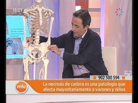 Dolor en la parte derecha de las 35 semanas Síntomas de la enfermedad de las articulaciones de la rodilla Hoff
