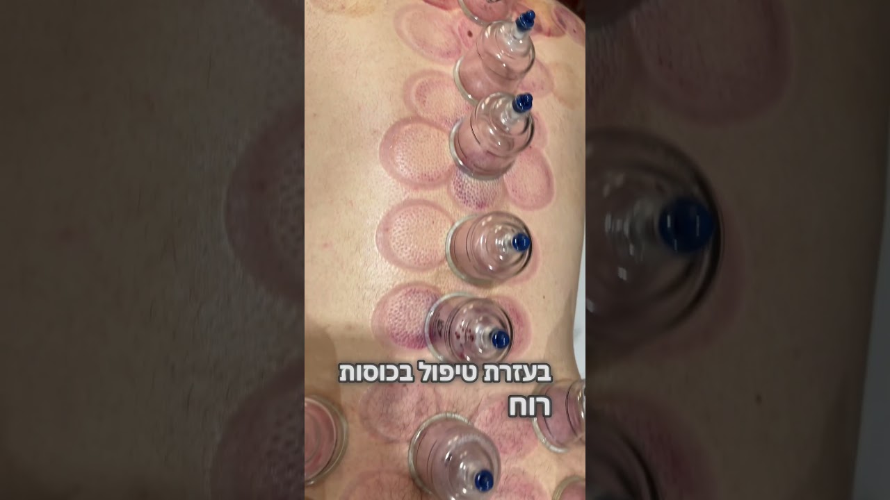 כאבי ראש? זה לא רק הראש זה הגוף כולו צביקה שנקר 050-8776451