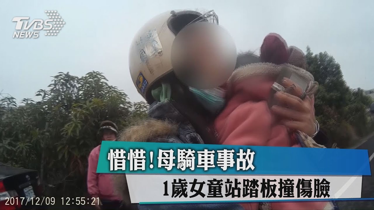 惜惜!母騎車事故 1歲女童站踏板撞傷臉