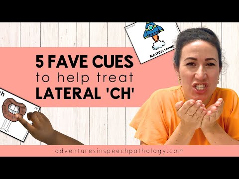 Five Fave Cues to Treat a Lateral "Ch" Sound
