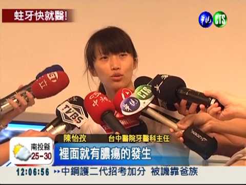 蛀牙引發蜂窩性組織炎 拔牙救命