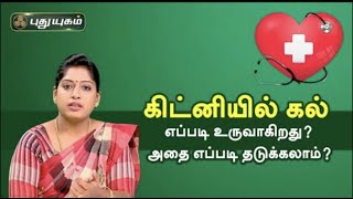 Doctor On Call 10-06-2022 PuthuYugam tv Show
