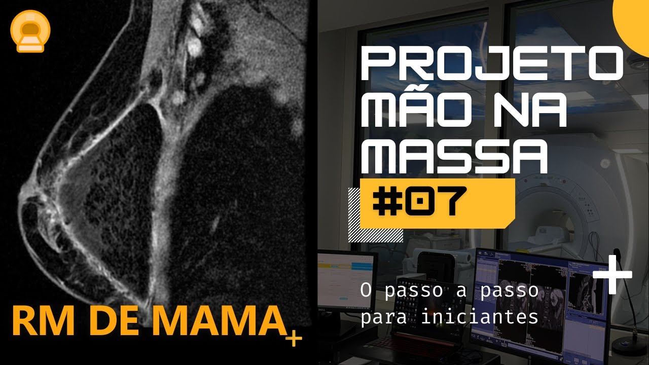 Mão Na Massa 07 | Os Segredos de uma RM de Mama