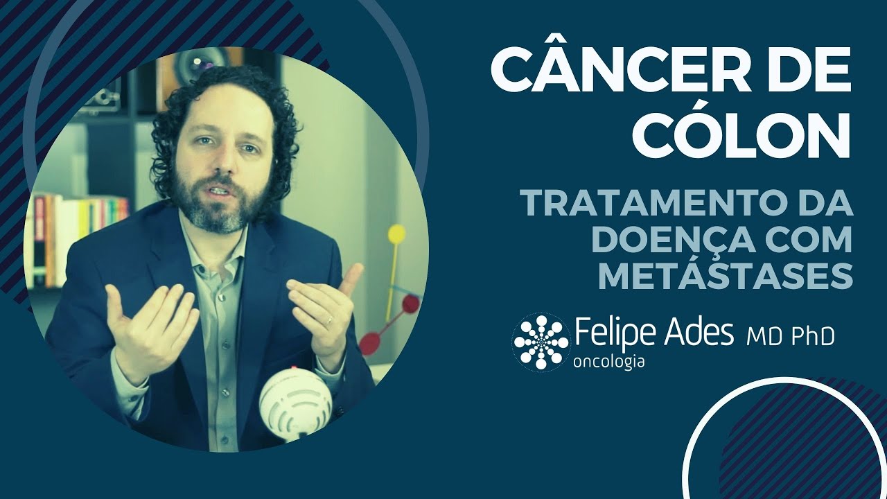 CÂNCER DE CÓLON | Como se trata um câncer de intestino com metástase?
