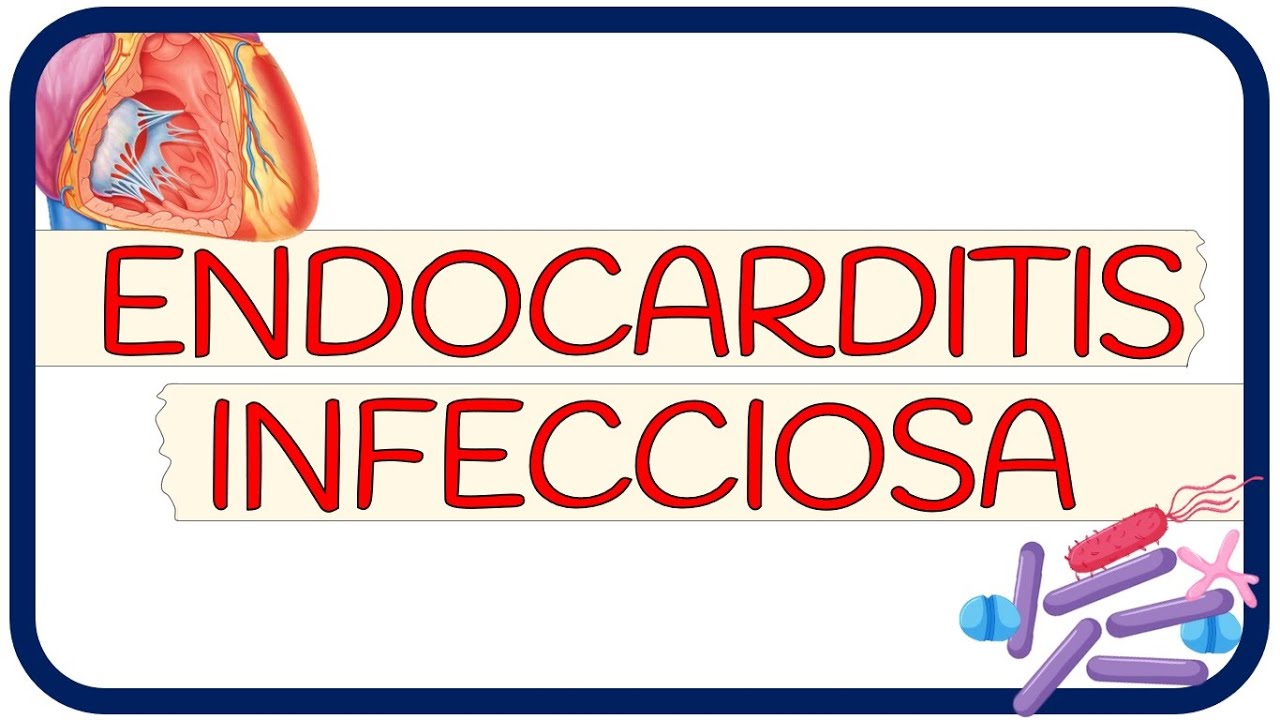 ENDOCARDITIS INFECCIOSA - fisiopatología, signos y síntomas, diagnóstico, tratamiento y prevención