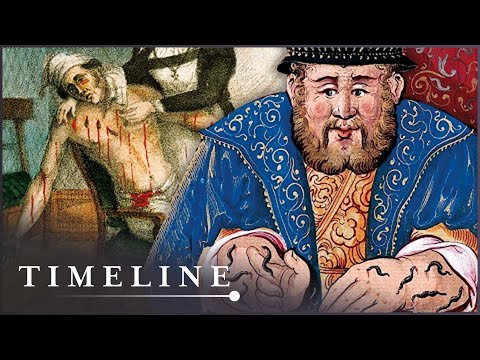Why Did Medieval People Cover Themselves In Bloodsucking Leeches? | Worst Jobs In History | Timeline