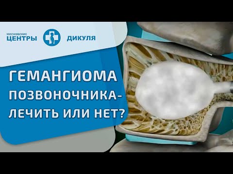 Юралан для суставов Кавинтон форте при шейном остеохондрозе
