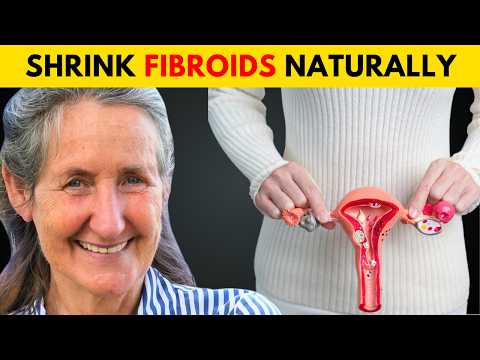 12 Foods That Shrink Fibroids (Naturally) | Barbara O’Neill