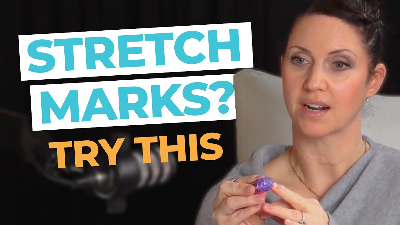 Best At-Home Treatments for Stretch Marks—The Proven Methods!