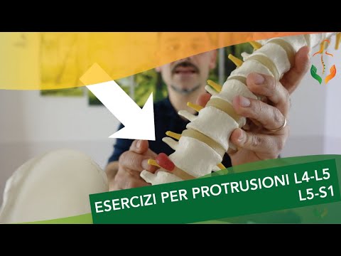 Esercizi per protrusioni  L4-L5 e L5 -S1. SOLLIEVO IMMEDIATO!