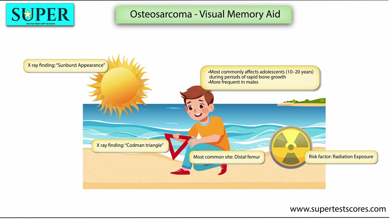 Osteosarcoma: Most Important Points for USMLE - YouTube